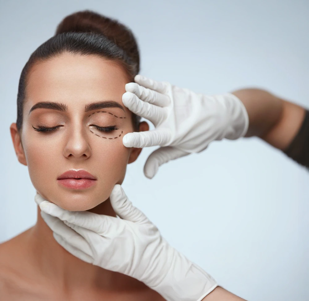 Cirurgia plástica ocular - SC Laser