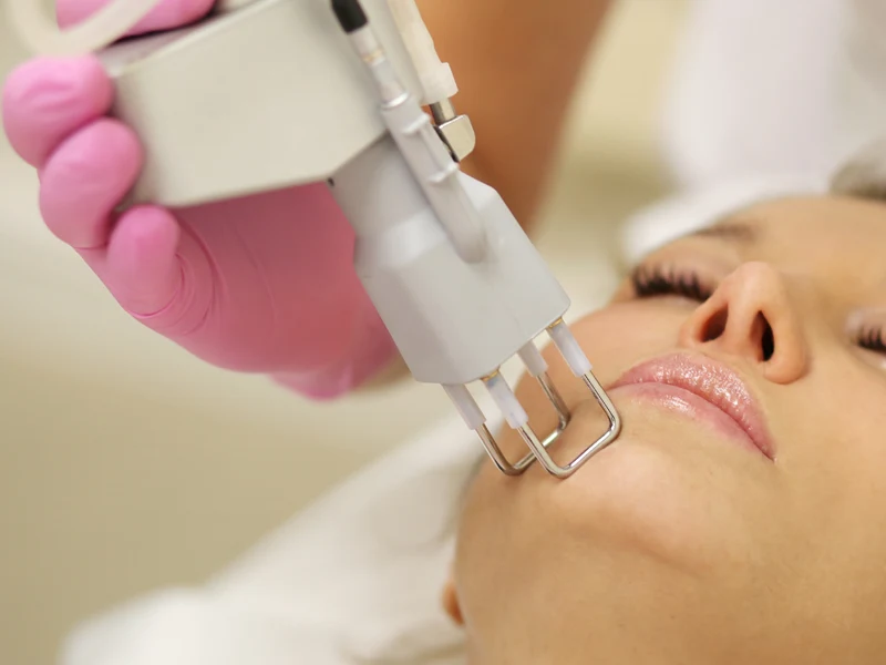 SmartXide Touch – Laser CO2 detalhe 5