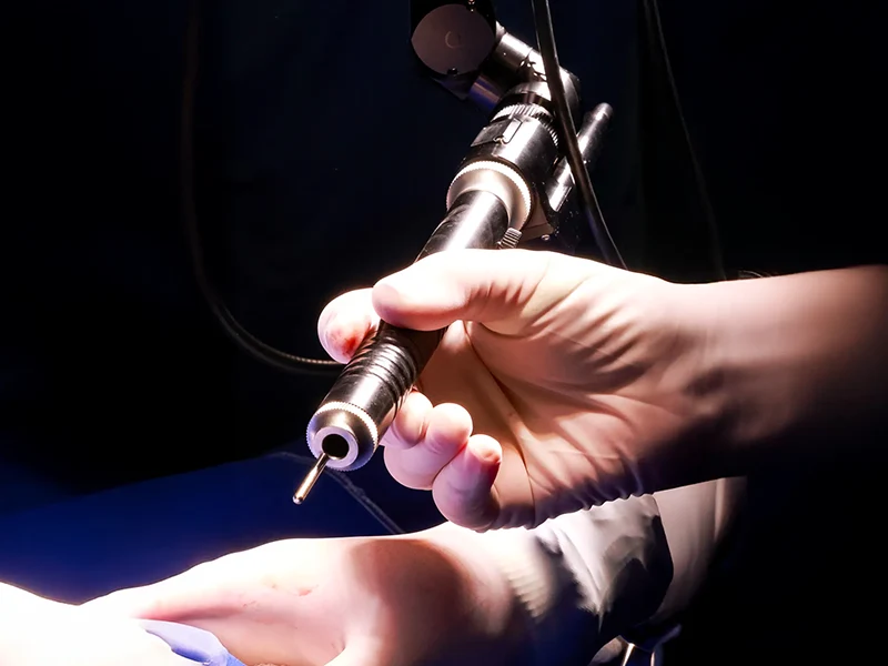 You Laser MT detalhe 5