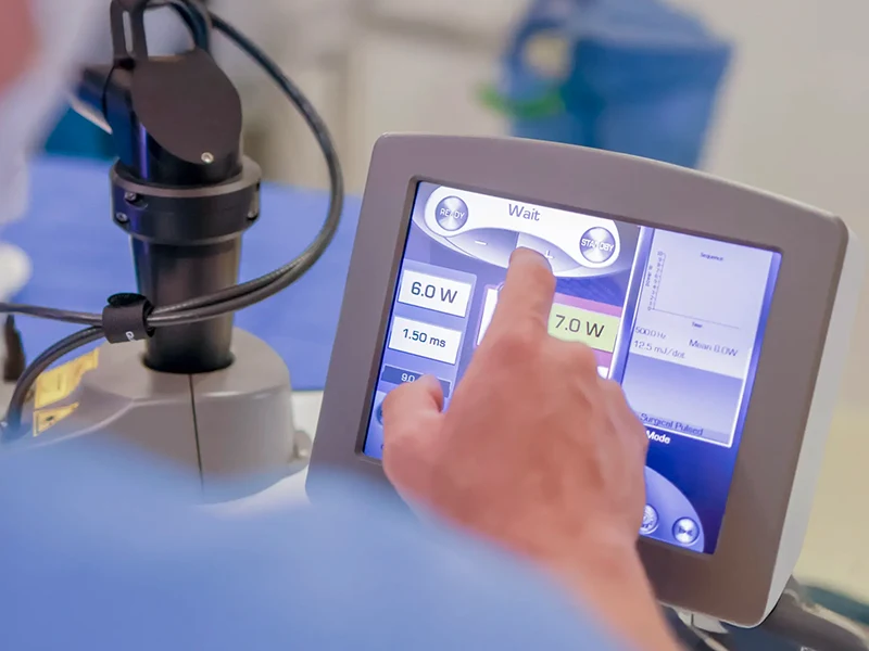 You Laser MT detalhe 6